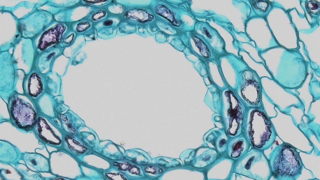 Gymnosperm Stem: Resin Duct in One Year Pinus
